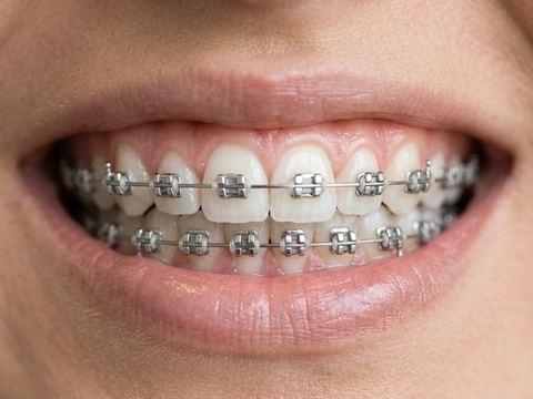 Braces and orthodontics in Tijuana — Dr. Rodolfo Castro
